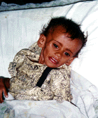 Acute starvation. Qadissiya Hospital. (Photo: Rick McDowell ) 