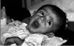 Child in Iraqi Hospital 1997