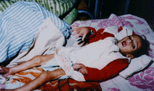 Basra Paediatric and Gynecology Hospital. Nassar Feyath 1 year old, suffering from nutritional Marasmus. (Photo: Chuck Quilty) 