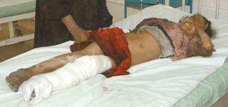 An Iraqi child injured in Najaf, as a result of US Shelling (Alhayat Aljadeeda, 4/1/03). 