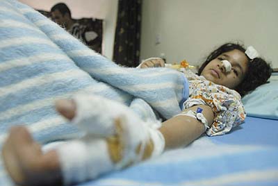 An Iraqi girl who was injured during the bombing of Al Shaab neighbourhood lies at a hospital in Baghdad on Thursday. Tears and rage lay in store in the neighbourhood known as the `City of the People' ahead of funerals for the 14 people killed when two missiles smashed into apartment complexes (AFP photo, JT, 3/28/03) 