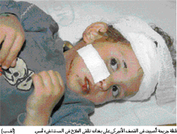 Another Iraqi child who was injured during the US missile attacks on Baghdad yesterday (Al-Ayyam, 4/1/03)